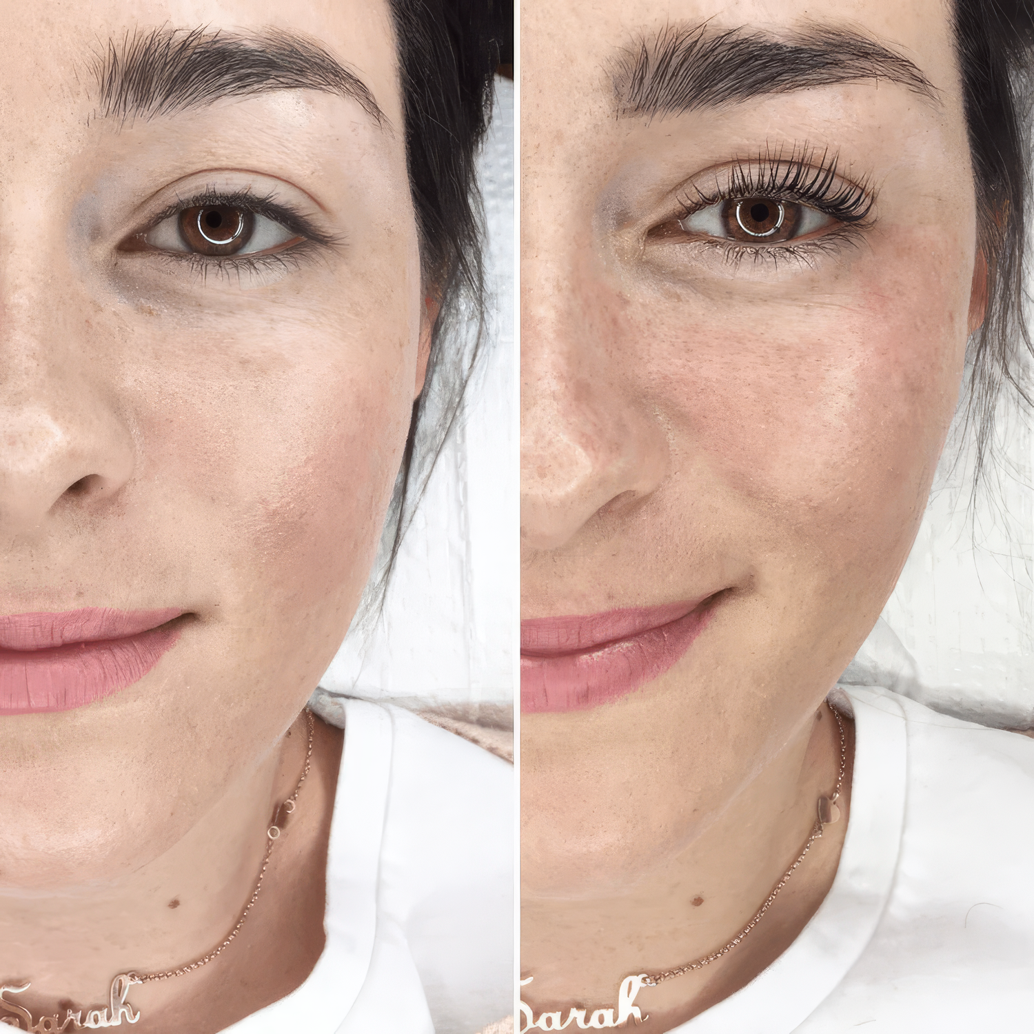 Beauty Skincare